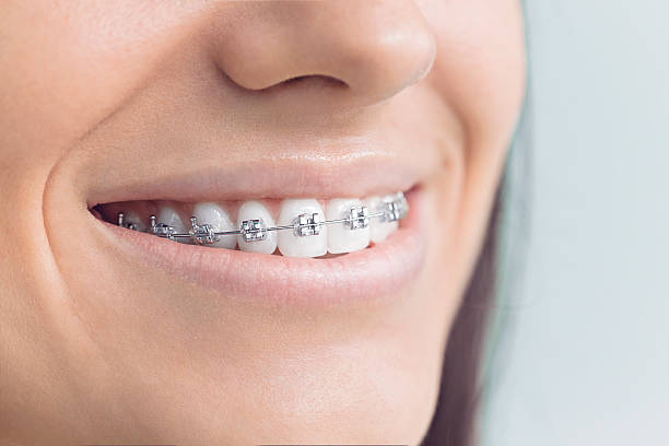 Best Teeth Whitening  in Hargill, TX
